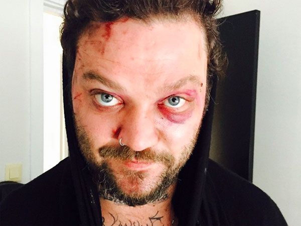 Bam Margera everything-pr Bam Margera everything-pr